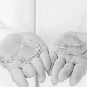 Retenedores dentales: ¿para qué sirven? ¿Cuándo hay que usarlos?