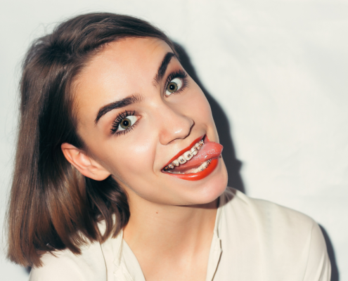 sonreír con brackets