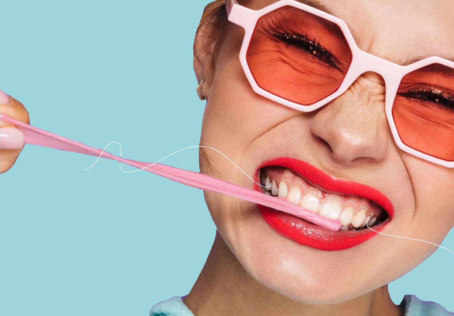 Tratamientos para corregir la sonrisa gingival