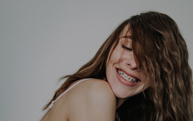 Brackets metálicos con gomas o ligaduras