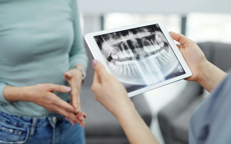 Qué es una ortopantomografía