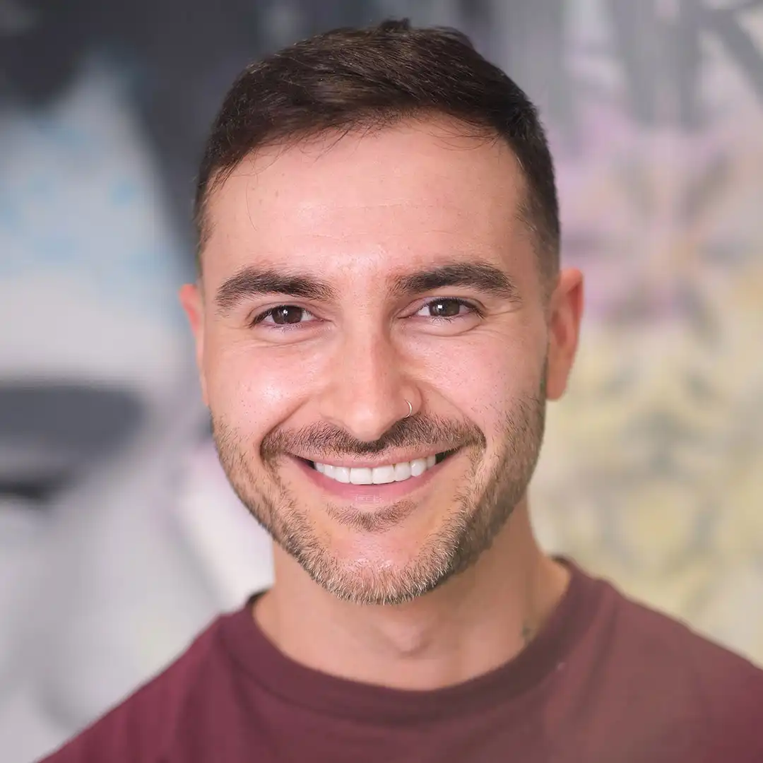 Una paciente nos muestra su sonrisa con carillas de composite