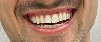 Hagen Darius, después