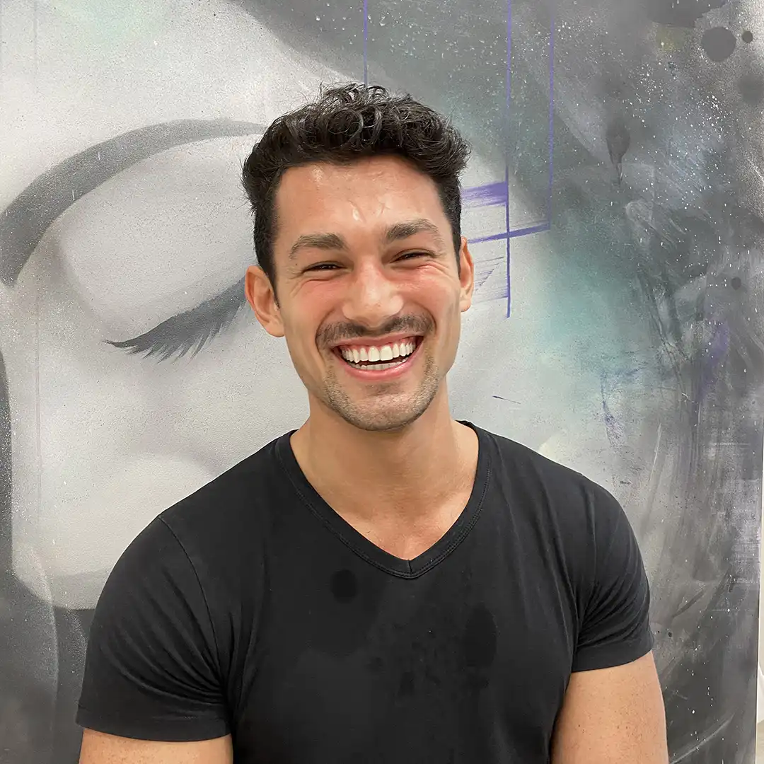 Una paciente nos muestra su sonrisa tras tratamiento de blanqueamiento