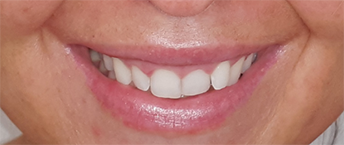 María Rodríguez, antes