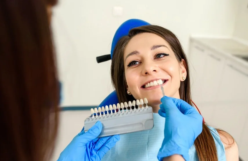¿Cómo cuidar las carillas dentales para que duren más tiempo?
