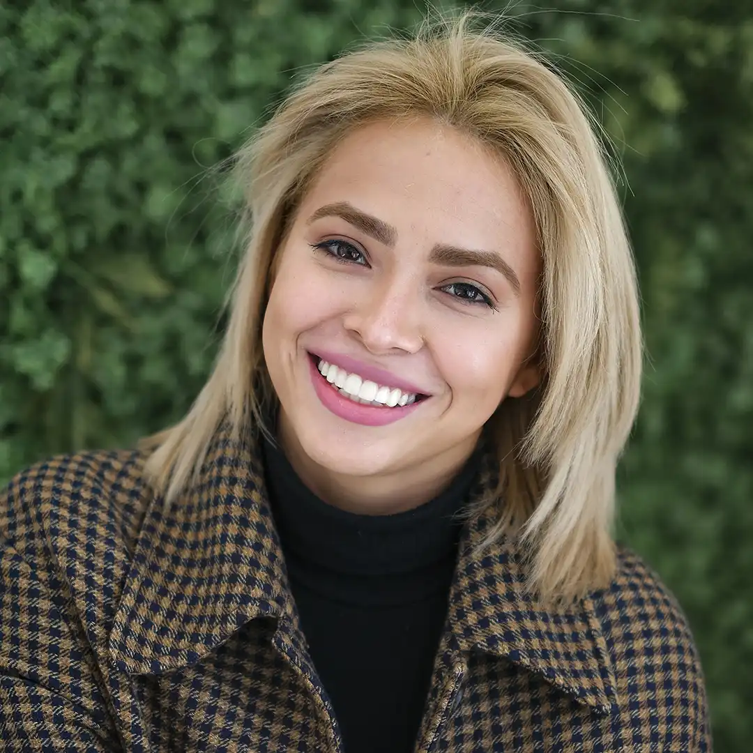 Carillas dentales de composite