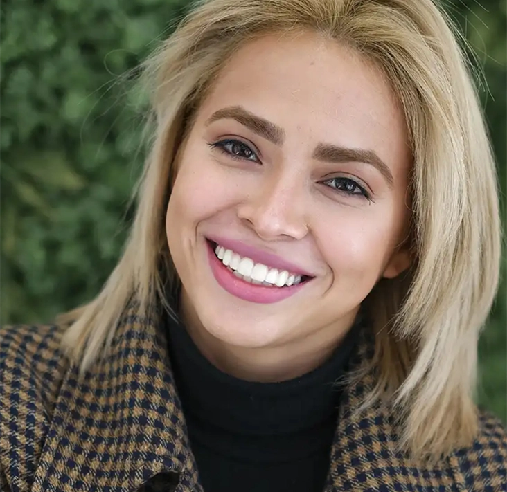 Mujer sonriente tras haber recibido un tratamiento de carillas de composite de Smysecret.