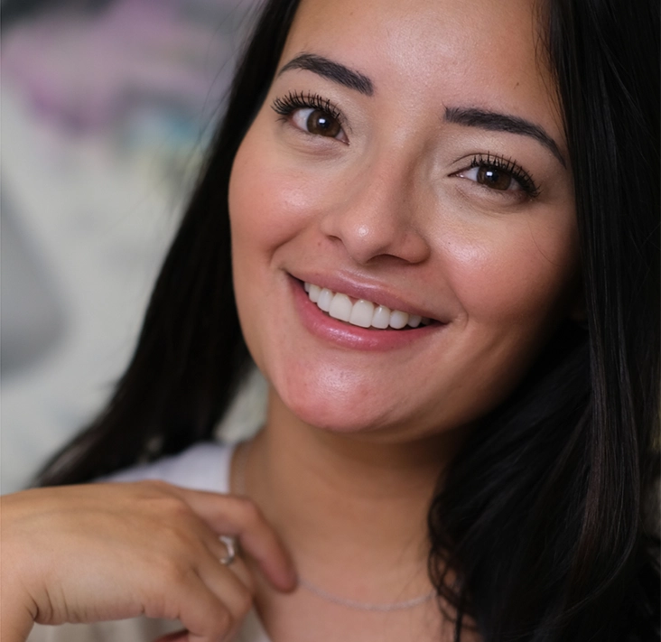 Mujer sonriente tras haber recibido un tratamiento de carillas dentales de Smysecret.