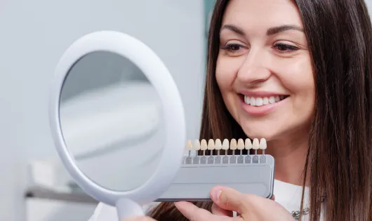 Carillas dentales de Smysecret.