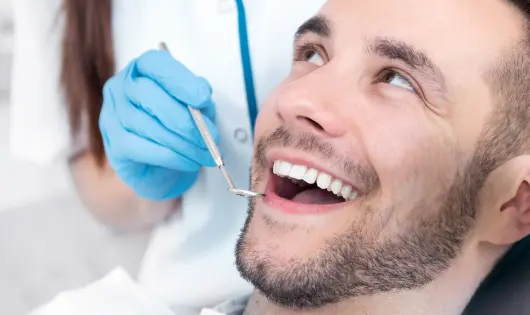 Segundo tipo de carillas de composite de Smysecret.