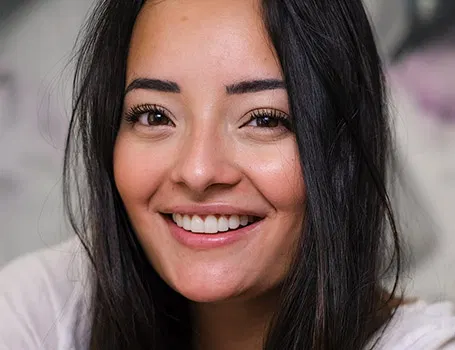 Una paciente muestra el resultado final del tratamiento de carillas de composite realizado en Smysecret.